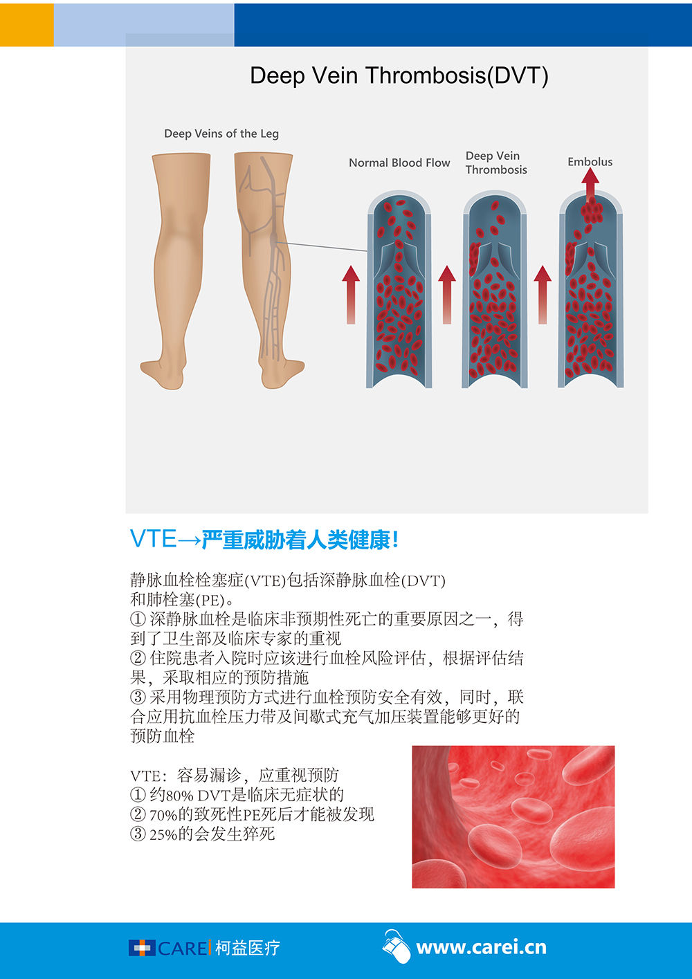 VenaFlow Elite System-f4.jpg