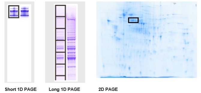 百泰派克2D SDS-PAGE示例